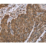 Immunohistochemistry - PLXNB1 Antibody from Signalway Antibody (37836) - Antibodies.com