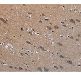 Immunohistochemistry - PLXND1 Antibody from Signalway Antibody (37837) - Antibodies.com