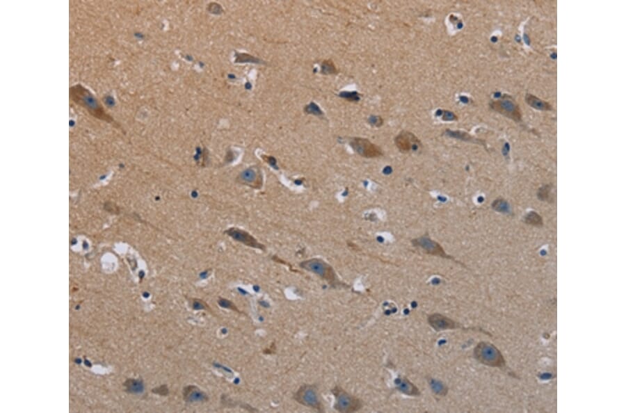 Immunohistochemistry - PLXND1 Antibody from Signalway Antibody (37837) - Antibodies.com