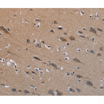 Immunohistochemistry - PLXND1 Antibody from Signalway Antibody (37837) - Antibodies.com