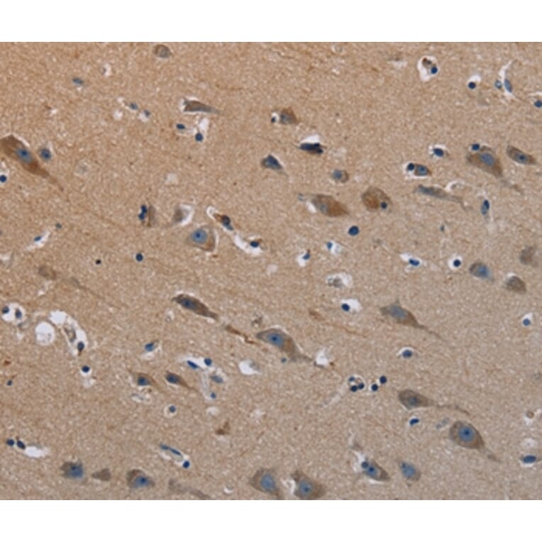 Immunohistochemistry - PLXND1 Antibody from Signalway Antibody (37837) - Antibodies.com