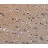 Immunohistochemistry - PLXND1 Antibody from Signalway Antibody (37837) - Antibodies.com