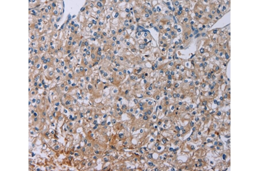 Immunohistochemistry - PLXND1 Antibody from Signalway Antibody (37837) - Antibodies.com