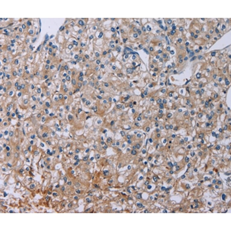 Immunohistochemistry - PLXND1 Antibody from Signalway Antibody (37837) - Antibodies.com