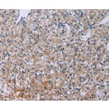 Immunohistochemistry - PLXND1 Antibody from Signalway Antibody (37837) - Antibodies.com