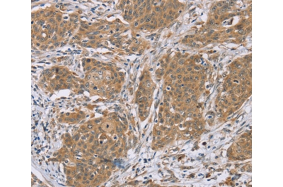 Immunohistochemistry - RNF139 Antibody from Signalway Antibody (37873) - Antibodies.com