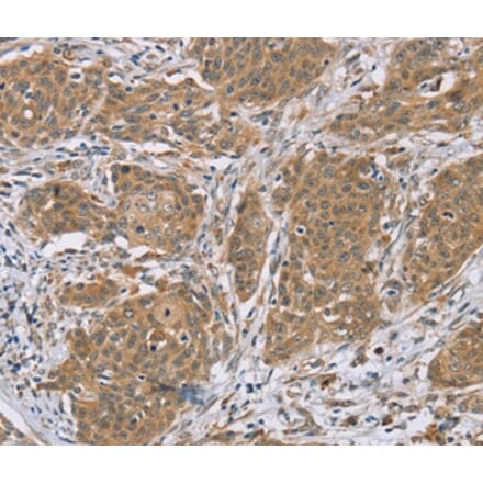 Immunohistochemistry - RNF139 Antibody from Signalway Antibody (37873) - Antibodies.com