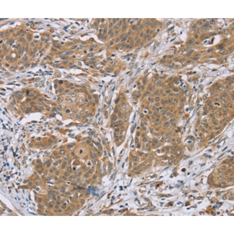 Immunohistochemistry - RNF139 Antibody from Signalway Antibody (37873) - Antibodies.com