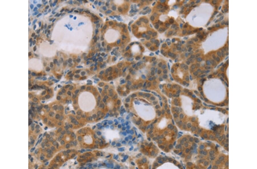 Immunohistochemistry - RNF139 Antibody from Signalway Antibody (37873) - Antibodies.com