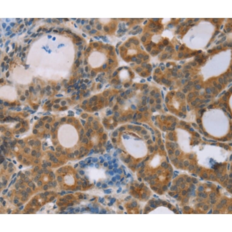 Immunohistochemistry - RNF139 Antibody from Signalway Antibody (37873) - Antibodies.com