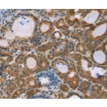 Immunohistochemistry - RNF139 Antibody from Signalway Antibody (37873) - Antibodies.com