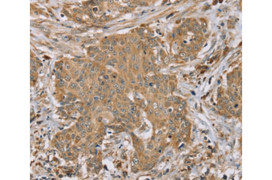 Immunohistochemistry - RNF148 Antibody from Signalway Antibody (37874) - Antibodies.com