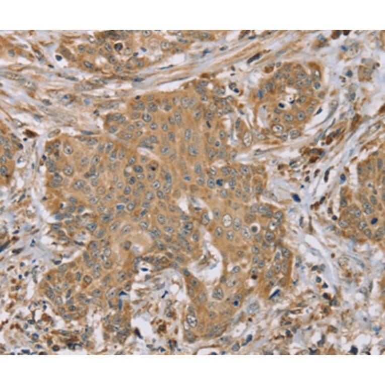 Immunohistochemistry - RNF148 Antibody from Signalway Antibody (37874) - Antibodies.com