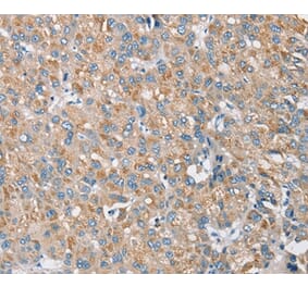 Immunohistochemistry - S100A9 Antibody from Signalway Antibody (37885) - Antibodies.com