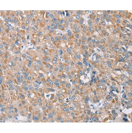 Immunohistochemistry - S100A9 Antibody from Signalway Antibody (37885) - Antibodies.com