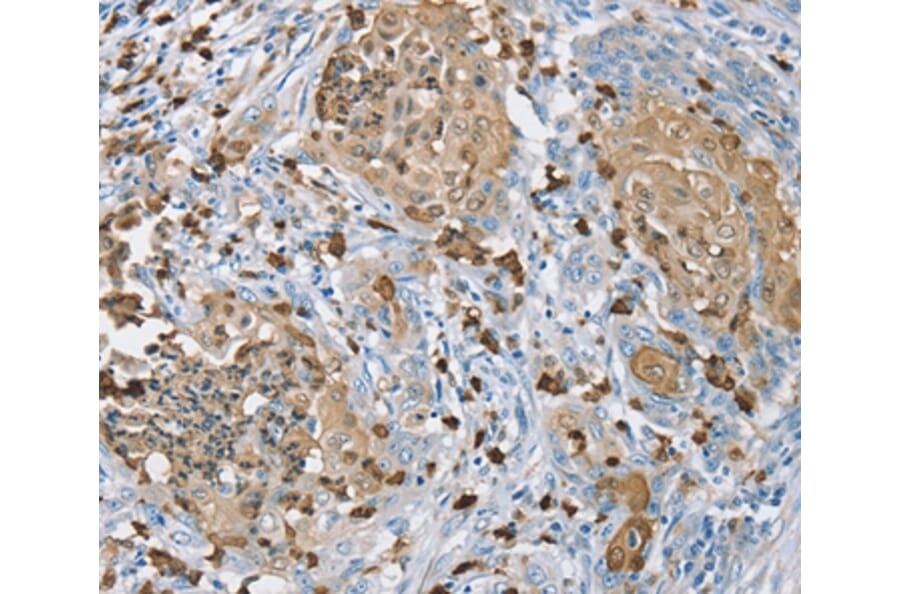 Immunohistochemistry - S100A9 Antibody from Signalway Antibody (37885) - Antibodies.com