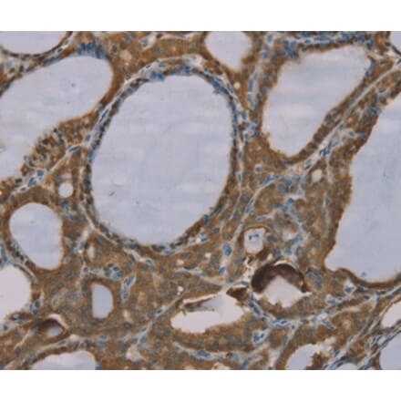 Immunohistochemistry - S100A6 Antibody from Signalway Antibody (37888) - Antibodies.com