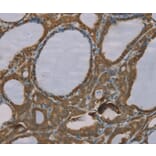 Immunohistochemistry - S100A6 Antibody from Signalway Antibody (37888) - Antibodies.com