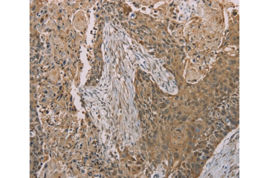 Immunohistochemistry - S100A6 Antibody from Signalway Antibody (37888) - Antibodies.com
