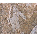 Immunohistochemistry - S100A6 Antibody from Signalway Antibody (37888) - Antibodies.com