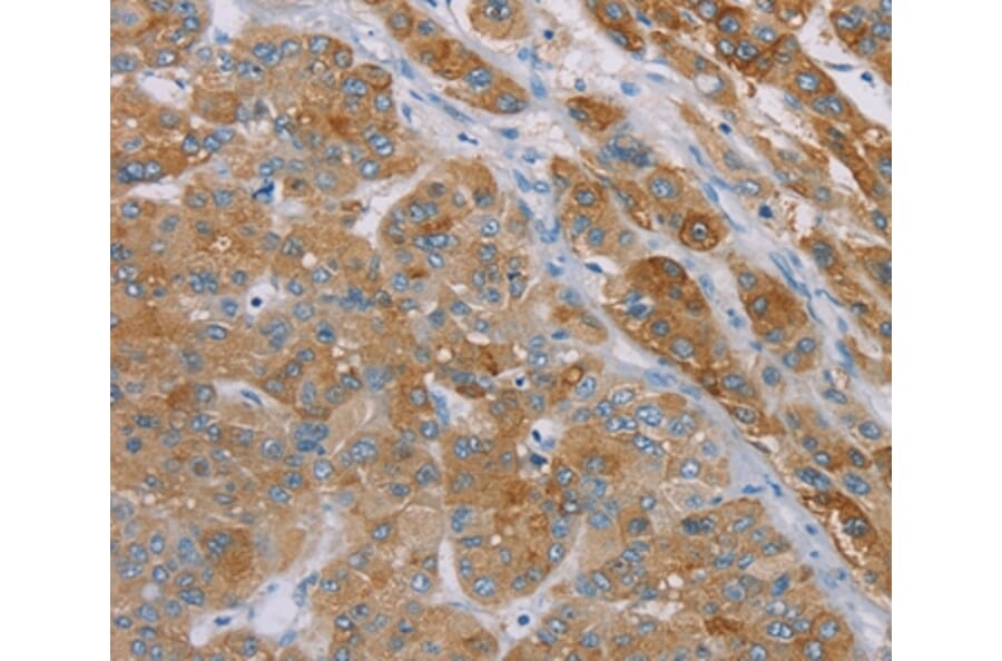 Immunohistochemistry - SAMD4A Antibody from Signalway Antibody (37889) - Antibodies.com