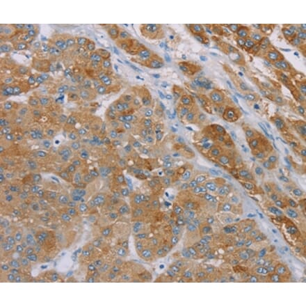Immunohistochemistry - SAMD4A Antibody from Signalway Antibody (37889) - Antibodies.com