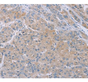 Immunohistochemistry - SAMD4B Antibody from Signalway Antibody (37890) - Antibodies.com