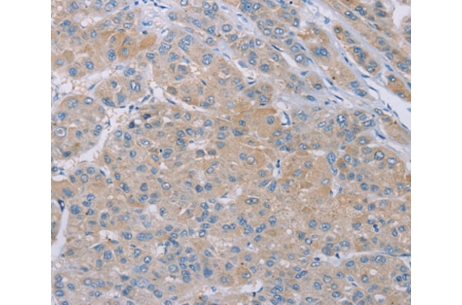 Immunohistochemistry - SAMD4B Antibody from Signalway Antibody (37890) - Antibodies.com