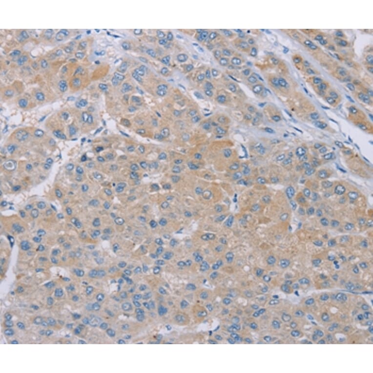 Immunohistochemistry - SAMD4B Antibody from Signalway Antibody (37890) - Antibodies.com