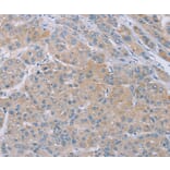 Immunohistochemistry - SAMD4B Antibody from Signalway Antibody (37890) - Antibodies.com