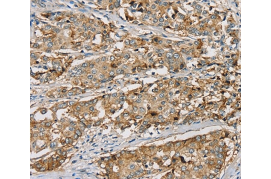 Immunohistochemistry - SEMA6A Antibody from Signalway Antibody (37906) - Antibodies.com