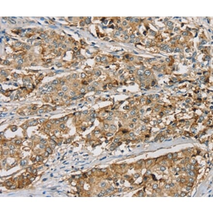 Immunohistochemistry - SEMA6A Antibody from Signalway Antibody (37906) - Antibodies.com