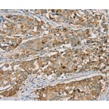 Immunohistochemistry - SEMA6A Antibody from Signalway Antibody (37906) - Antibodies.com