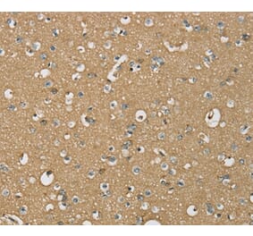 Immunohistochemistry - ATP2A3 Antibody from Signalway Antibody (37910) - Antibodies.com