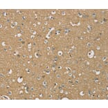 Immunohistochemistry - ATP2A3 Antibody from Signalway Antibody (37910) - Antibodies.com
