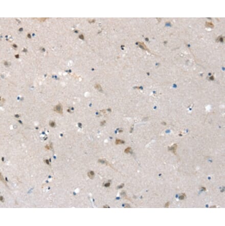 Immunohistochemistry - SLC6A7 Antibody from Signalway Antibody (37948) - Antibodies.com