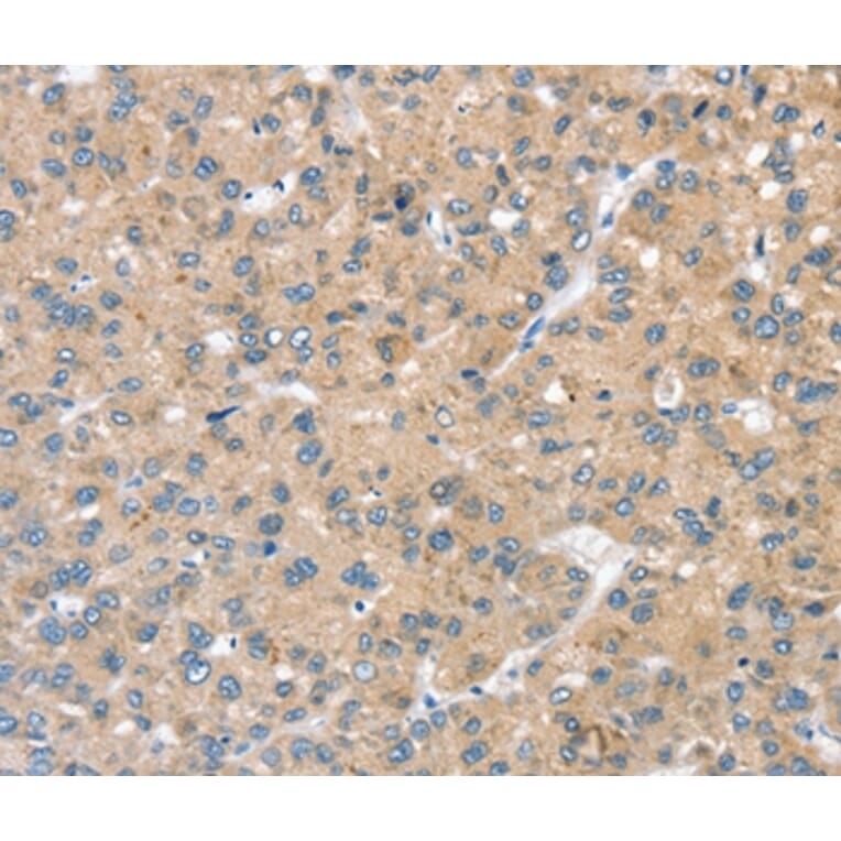 Immunohistochemistry - STK32C Antibody from Signalway Antibody (37971) - Antibodies.com