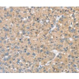 Immunohistochemistry - STK32C Antibody from Signalway Antibody (37971) - Antibodies.com