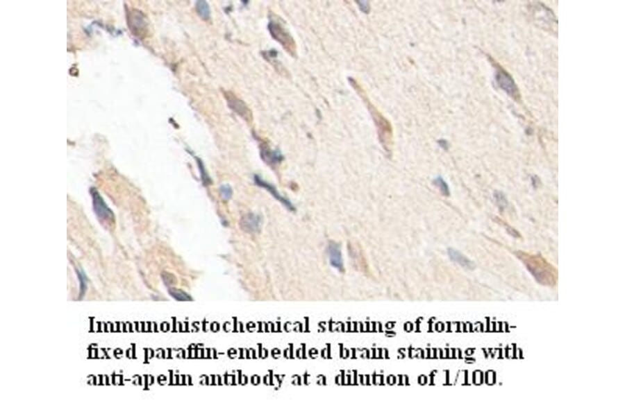 apelin Antibody from Signalway Antibody (39401) - Antibodies.com