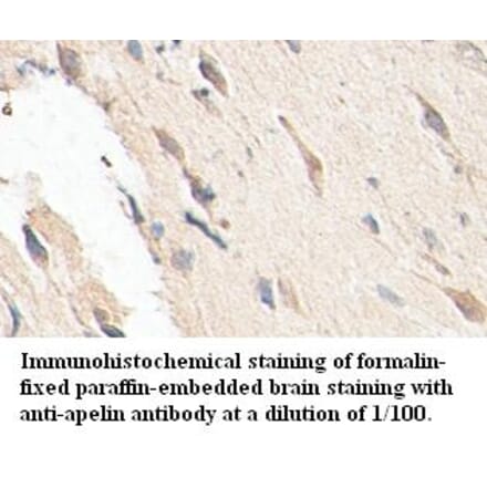 apelin Antibody from Signalway Antibody (39401) - Antibodies.com