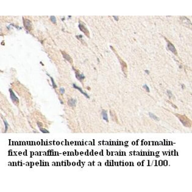 apelin Antibody from Signalway Antibody (39401) - Antibodies.com