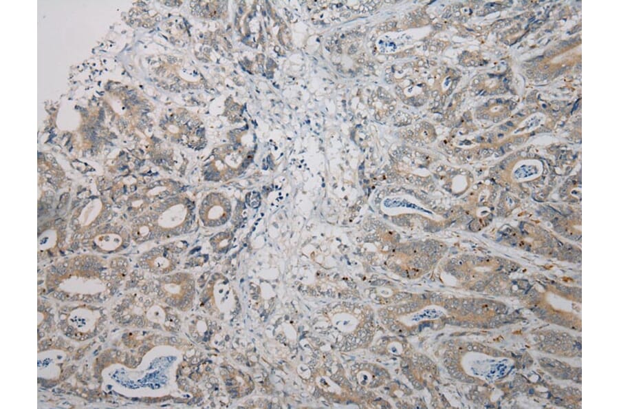 Immunohistochemistry - RNF185 Antibody from Signalway Antibody (40082) - Antibodies.com