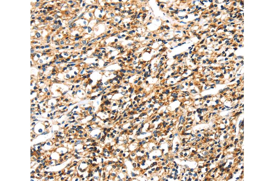 Immunohistochemistry - SEMA4A Antibody from Signalway Antibody (40097) - Antibodies.com