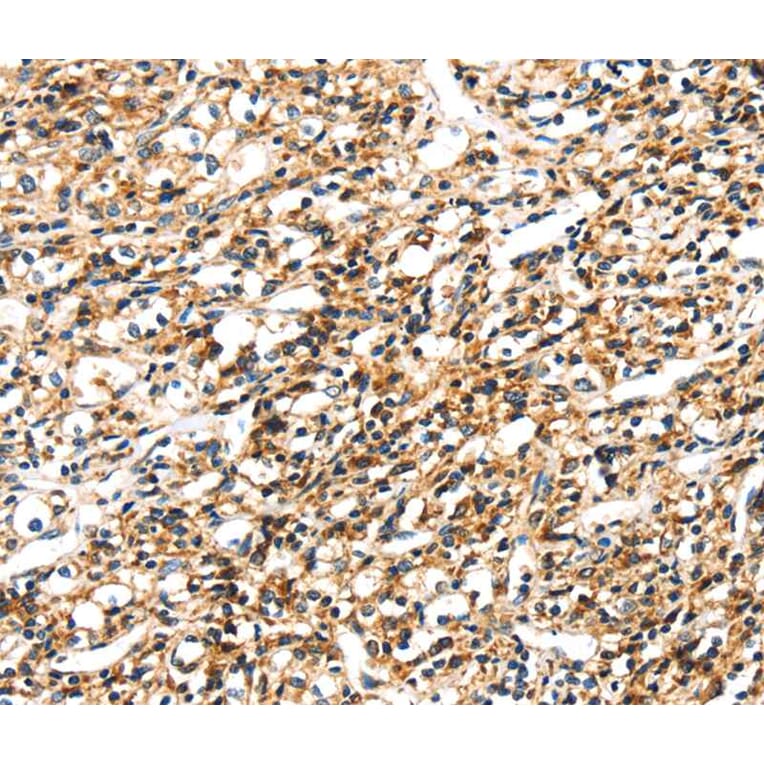Immunohistochemistry - SEMA4A Antibody from Signalway Antibody (40097) - Antibodies.com