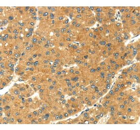 Immunohistochemistry - SEMA4C Antibody from Signalway Antibody (40099) - Antibodies.com