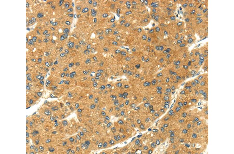 Immunohistochemistry - SEMA4C Antibody from Signalway Antibody (40099) - Antibodies.com