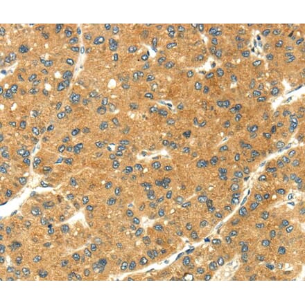 Immunohistochemistry - SEMA4C Antibody from Signalway Antibody (40099) - Antibodies.com