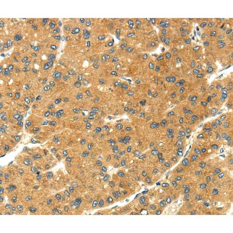 Immunohistochemistry - SEMA4C Antibody from Signalway Antibody (40099) - Antibodies.com
