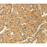 Immunohistochemistry - SEMA4C Antibody from Signalway Antibody (40099) - Antibodies.com