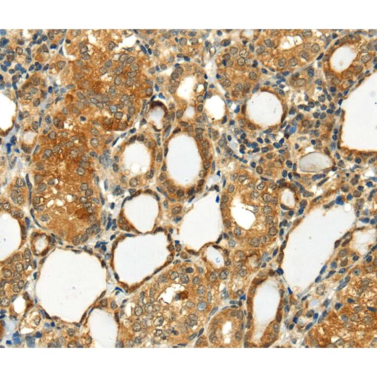 Immunohistochemistry - SEMA4C Antibody from Signalway Antibody (40099) - Antibodies.com